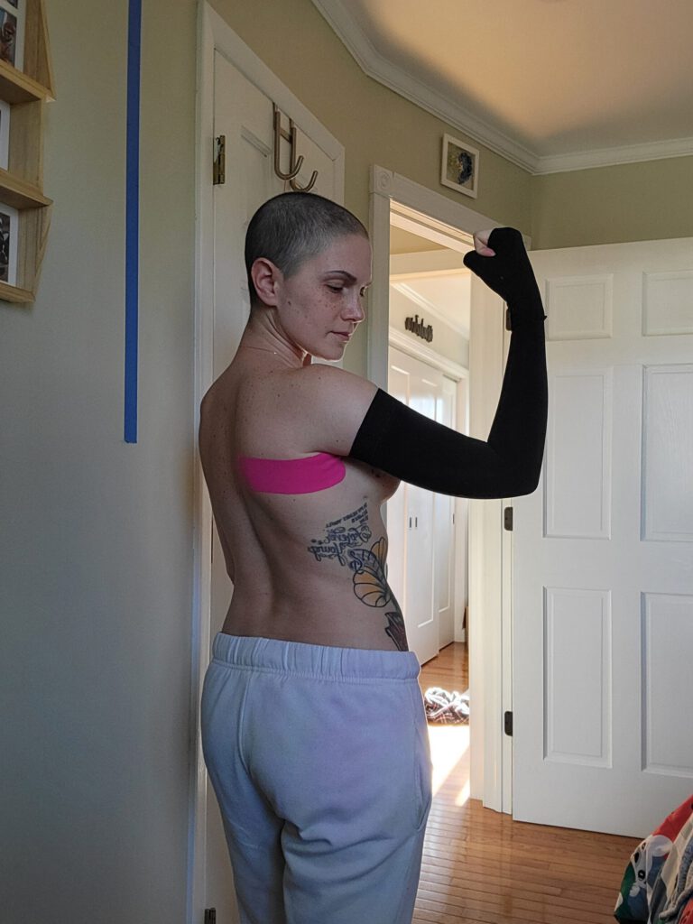 lymphedema and breast cancer survivors